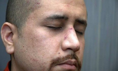 This Feb. 27 photo released by the Florida State Attorney&amp;#039;s Office shows George Zimmerman, who shot and killed Trayvon Martin, with injuries to his nose. The photograph was among a trove of e