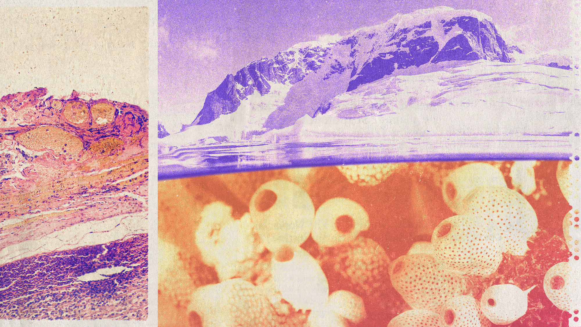 Photo collage of a micrograph of melanoma, an Antarctic iceberg, and sea squirts under water