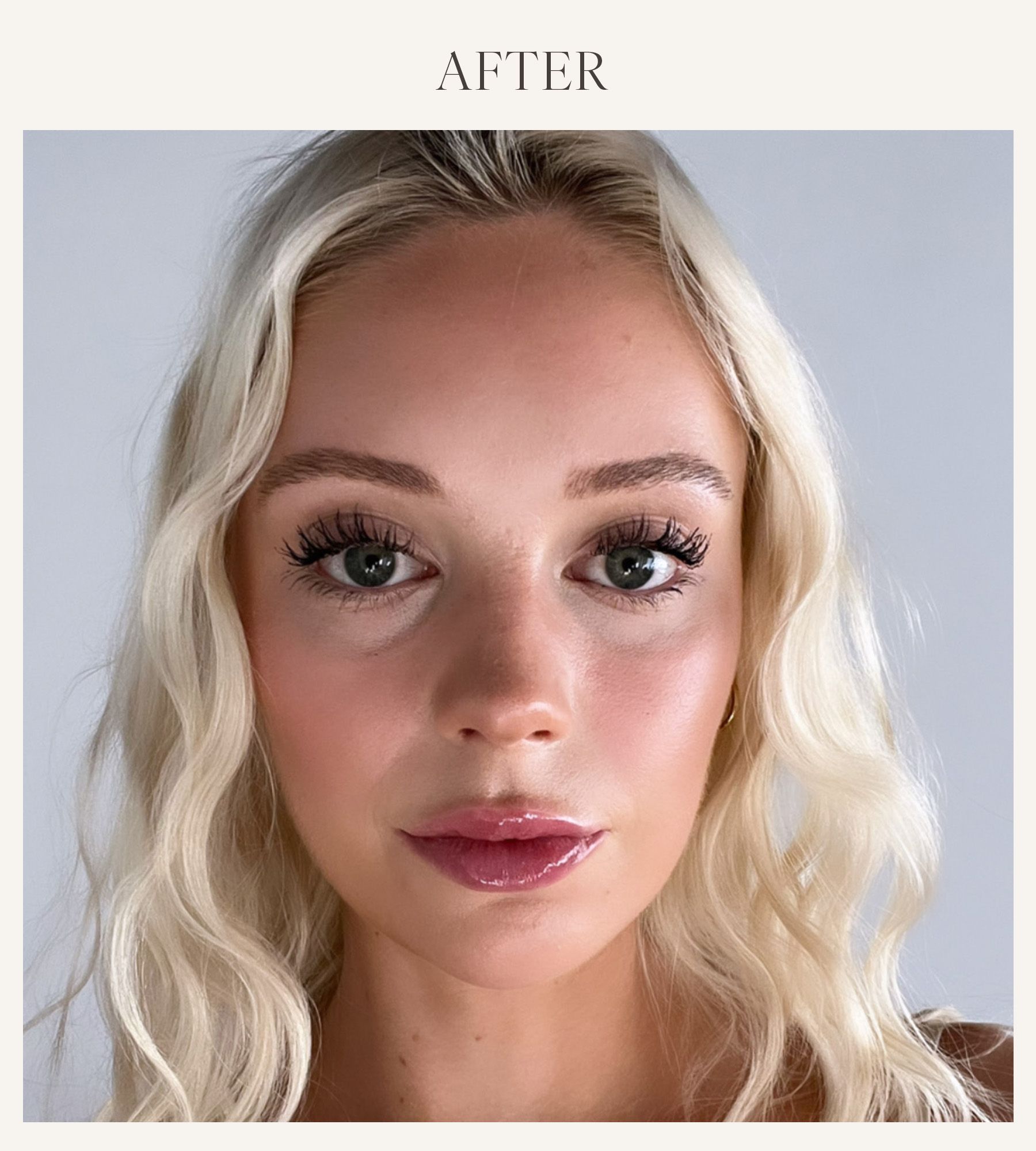 After photo of Erin Jahns testing the Dr. Lara Devgan lip plumper