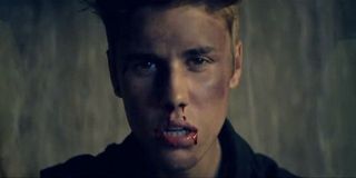 Justin Bieber looks kind of beat up