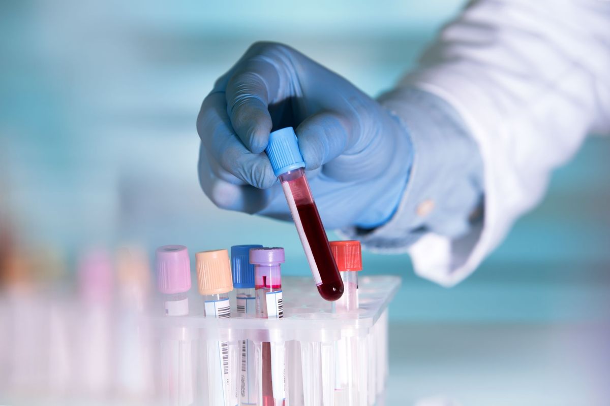 A lab technician holding a blood sample.