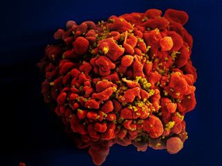 A scanning electron microscope image of an HIV-infected T cell.