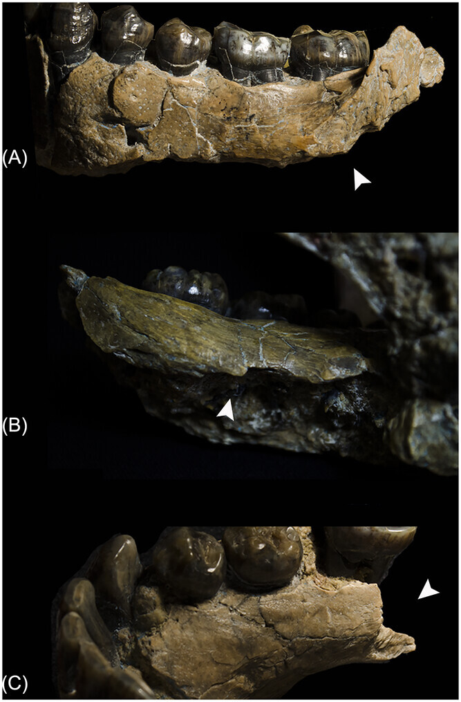 a close-up of details on a human jaw bone