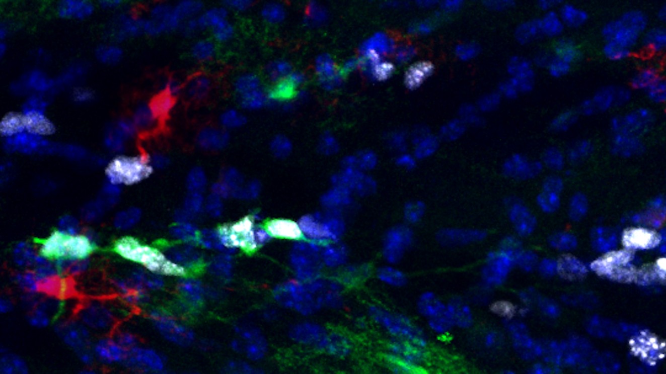 A high-resolution, fluorescent microscope image of astrocytes in the brain. The astrocytes are shown in red and green and the proliferative ones are also white. They look like blobs against a black background.