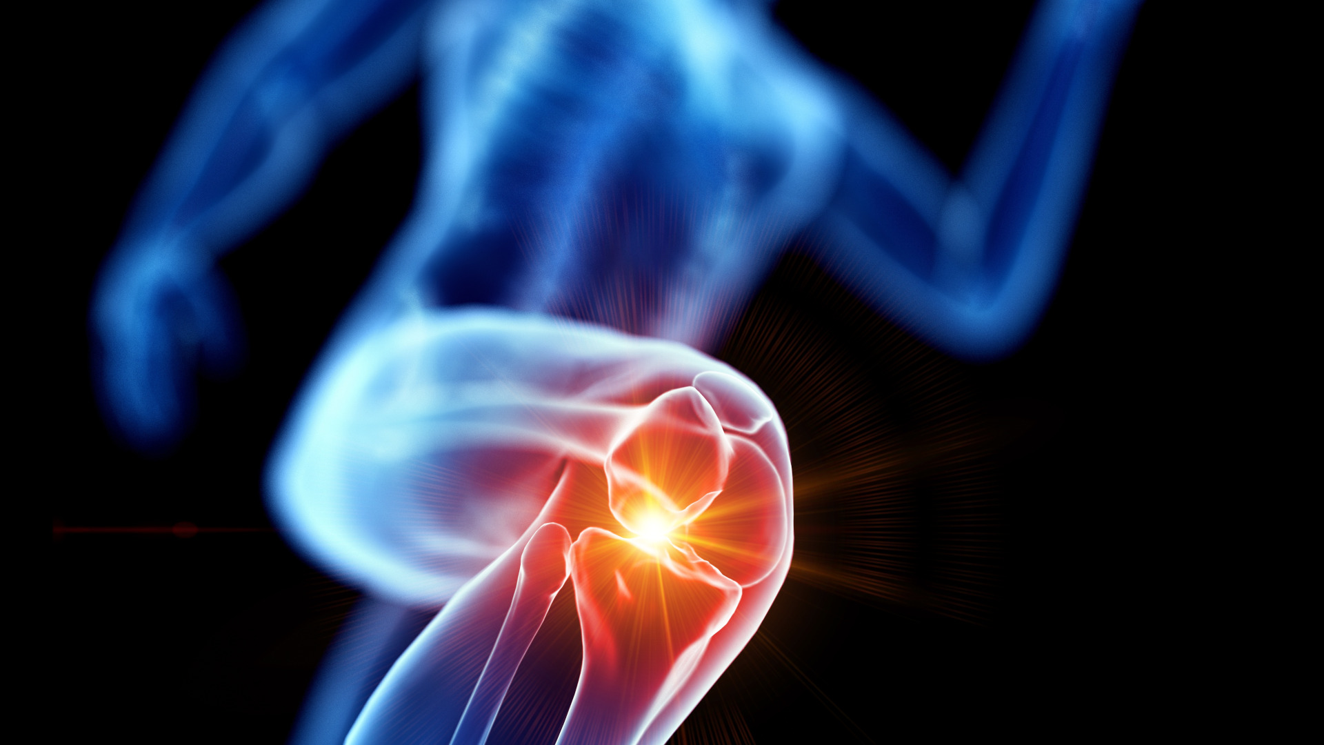 What is runner’s knee? And how can you avoid it? | Advnture