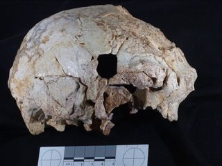 Hominin Skull