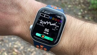 The Gentler Streak app running on an Apple Watch Series 10.