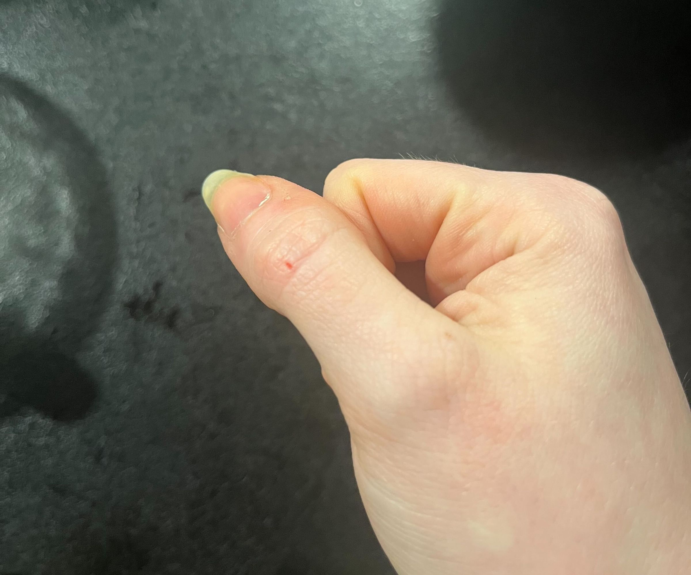 A small nick in the skin of my thumb after drying the Bialetti Venus