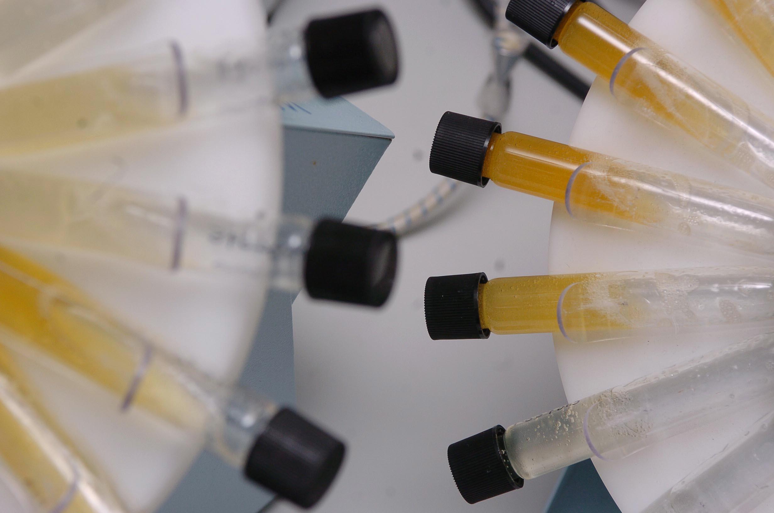 Olympics Drugs Test