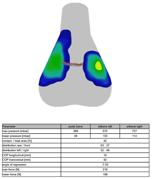 A visual output of saddle pressure mapping