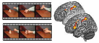This image shows the movies shown to the participants (left) and brain activation of the participants with psychopathy without instructions (behind) and with instructions to empathize (front).