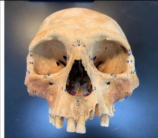 This skull from the Caribbean shows the 16 facial "landmarks" the researchers used to draw patterns between cultures.