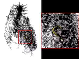 A CT scan image showing black-and-white outlines. You can see the ribs of the crocodile, as well as an assortment of shapes in the stomach area. A hook is highlighted in yellow.