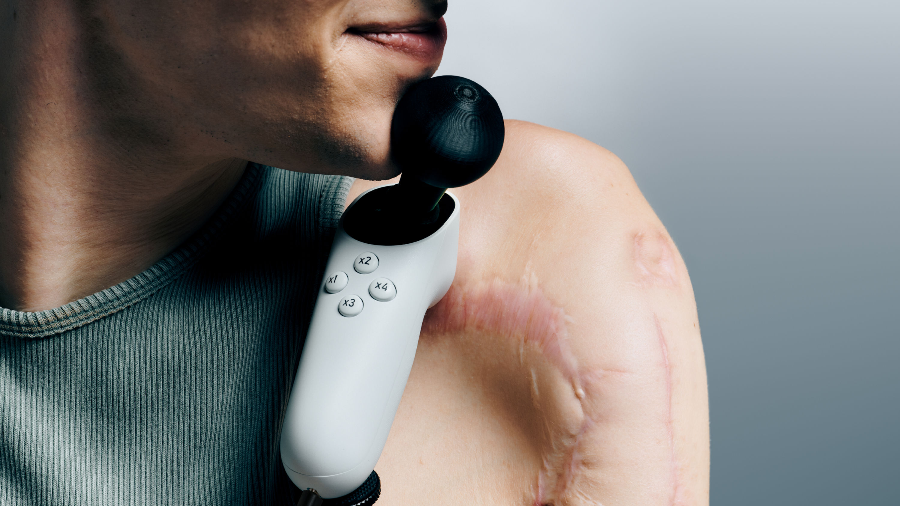 A gamer with extensive scars on their shoulder utilizes their chin to manipulate a large thumbstick grip on the Xbox Adaptive Joystick.