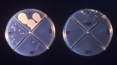 photo of two circular petri dishes with colonies of mycobacterium tuberculosis growing on them