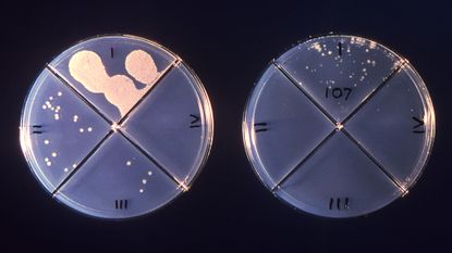 photo of two circular petri dishes with colonies of mycobacterium tuberculosis growing on them