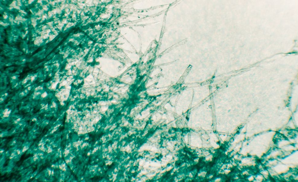 Dont Miss These Images Herpes Often Mistaken For Paper Cuts - 3z4mv4b