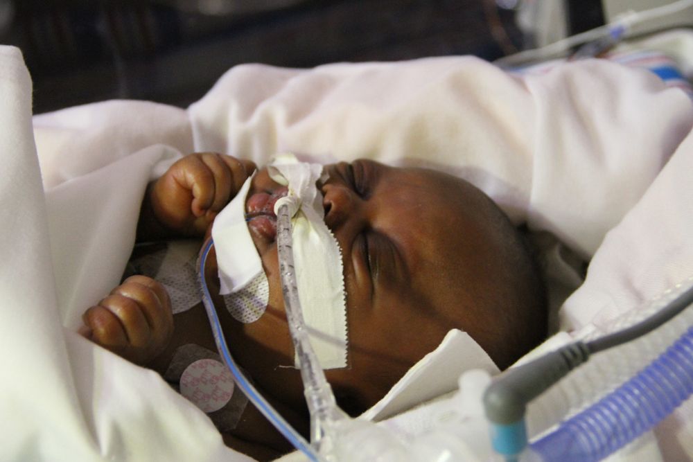 Preemies in Pain Get Relief with Micro-Pacifier | Live Science