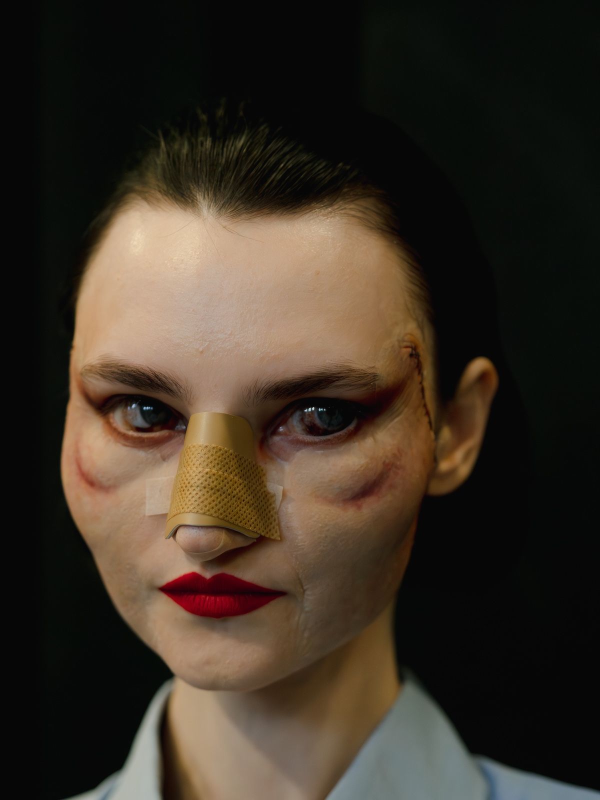 Model at Matières Fécales wearing post-op prosthetics, bandages, bruised eyes and red lipstick