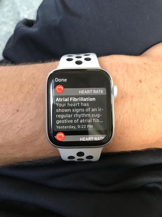 watchOS 9.4 expands Afib History feature to more countries, more