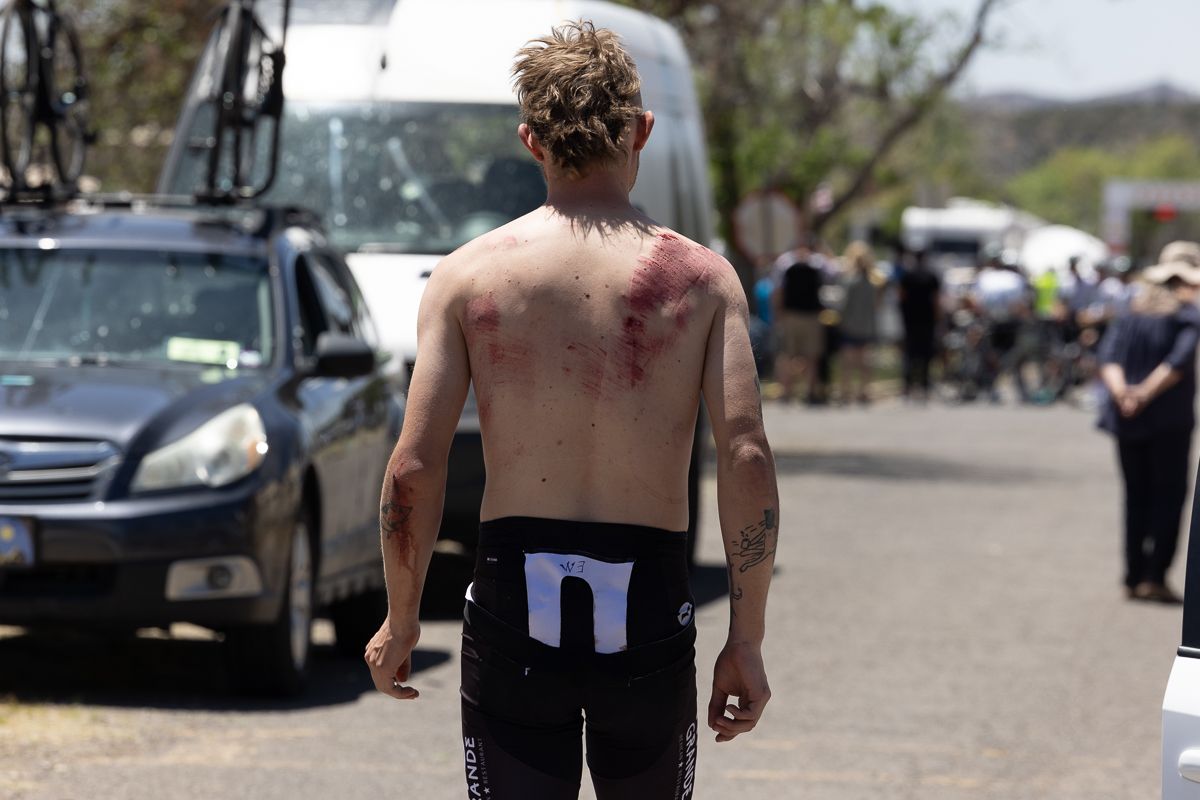 501.jpg A large crash on the way to the 2nd KOM took it's toll on the field, a number of riders including lopez had to abandon. Another segment arrived at the finish with road rash, cuts and bruises