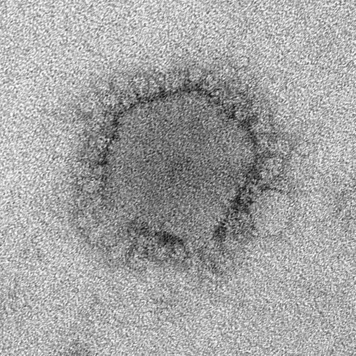 A highly magnified picture of the Middle East Respiratory Syndrome Coronavirus (MERS-CoV).