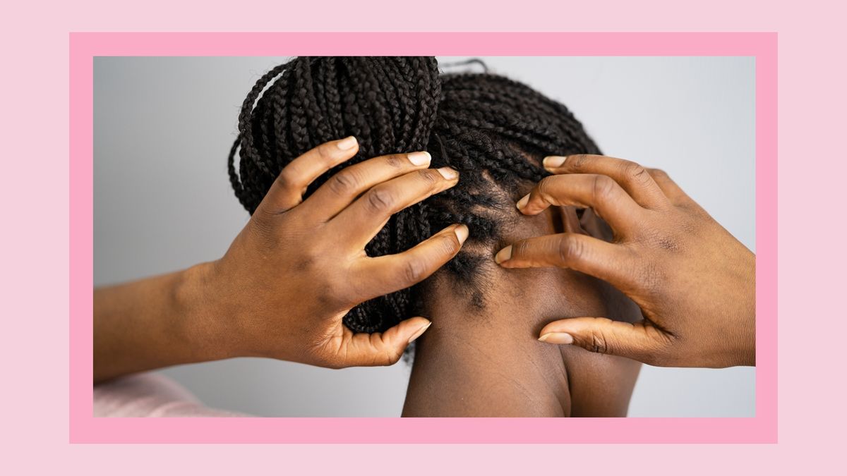 What is hair tapping? The latest scalp massage buzzword My Imperfect Life