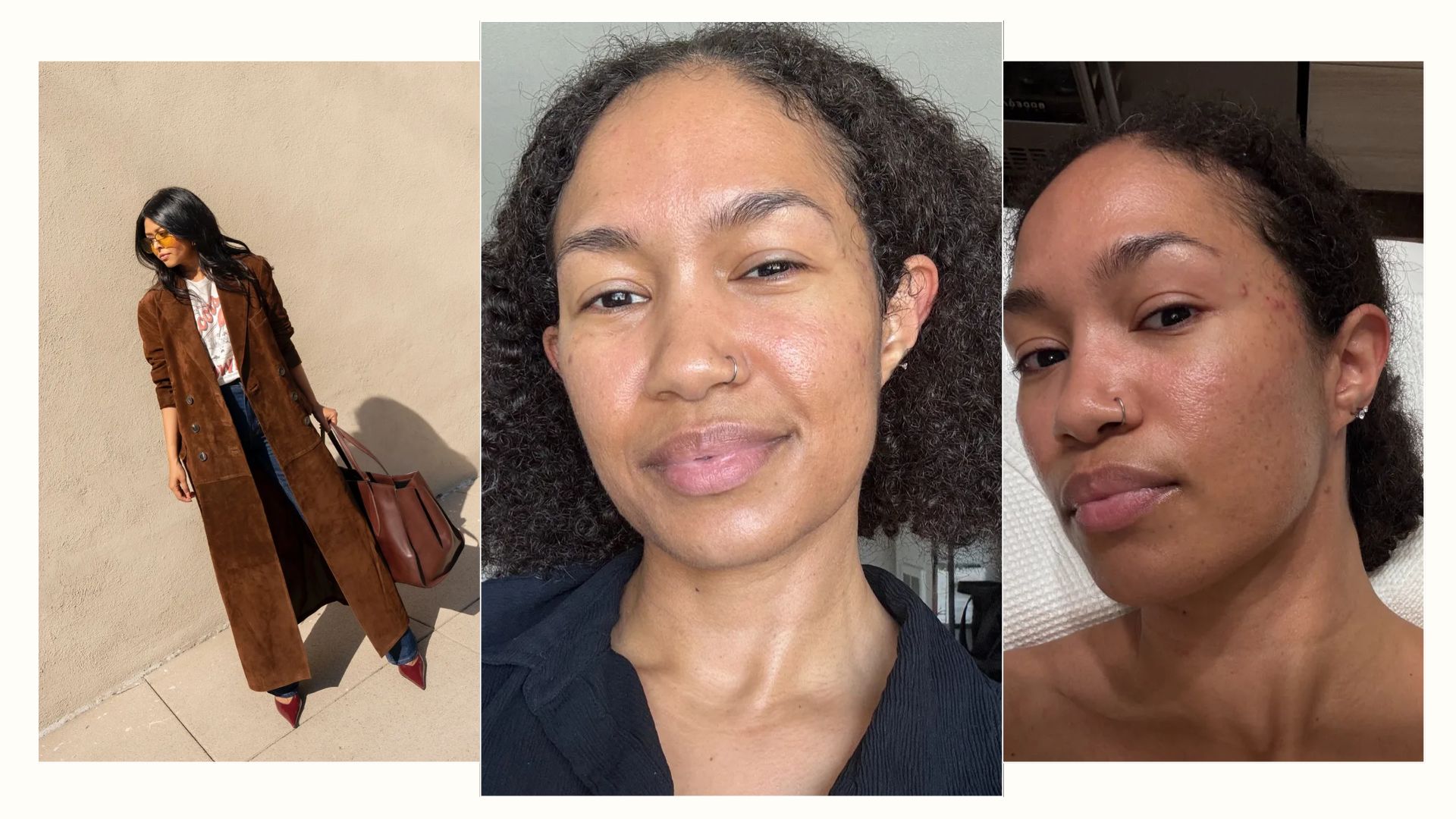 @shawnasimonee showing her skin before and after the VT Cosmetics Reedle Shot and a stylish influencer with glowing skin