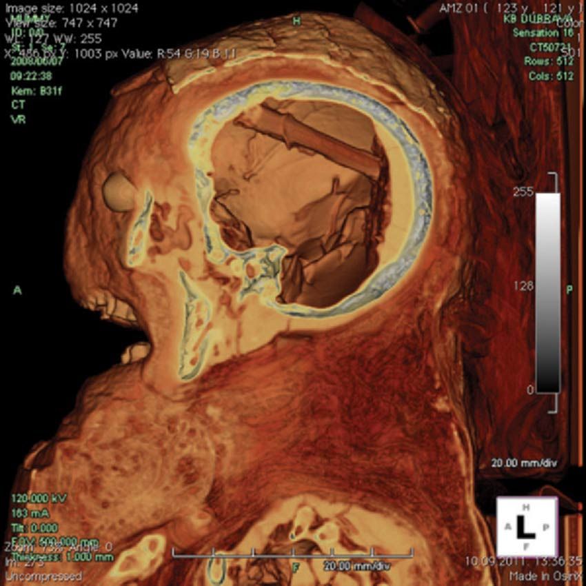 female egyptian mummy ct scan