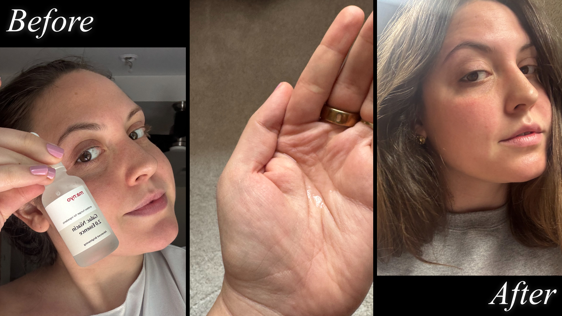 Contributing Beauty Writer Sophia Vilensky tests ma:nyo&#039;s Galac Niacin 2.0 serum.