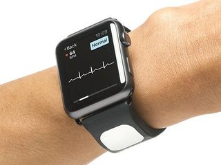 The Kardia Band for Apple Watch puts a medical grade EKG on your