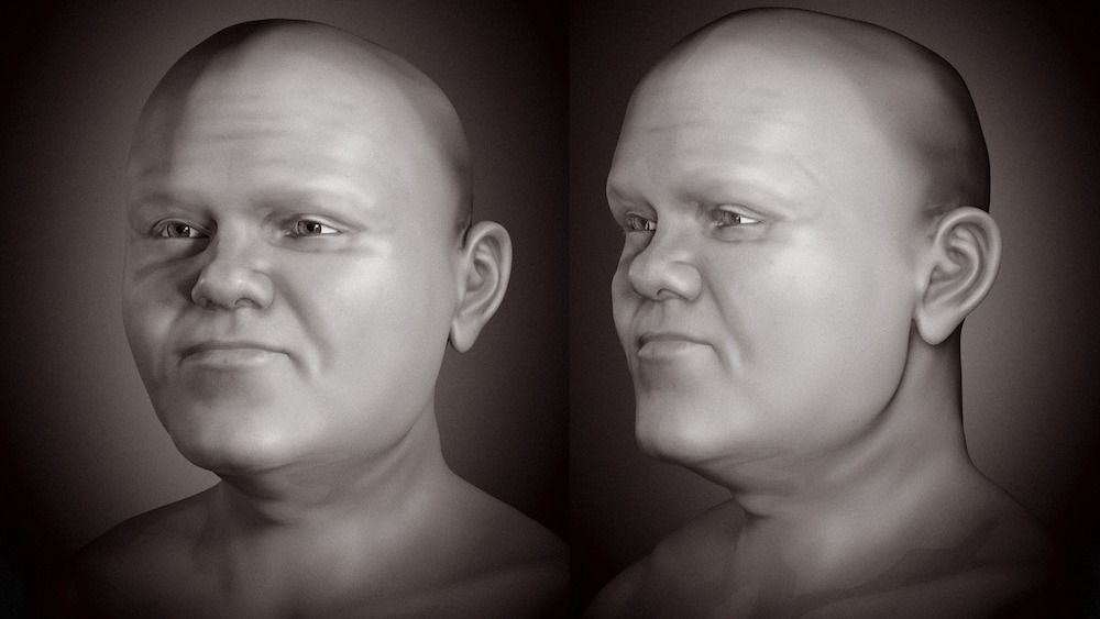 See the stunning facial approximation of a medieval man with dwarfism ...