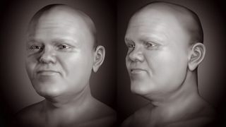 A black and white facial approximation of a man with dwarfism. 