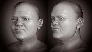 A black and white facial approximation of a man with dwarfism.