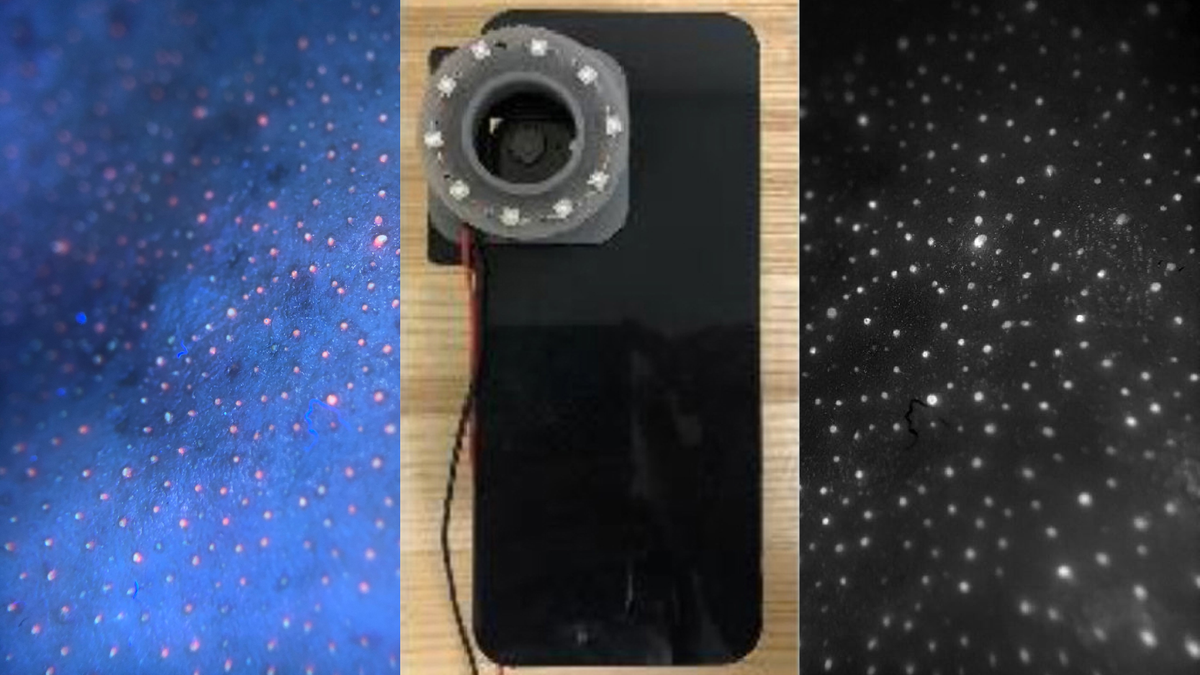 bacteria smartphone camera