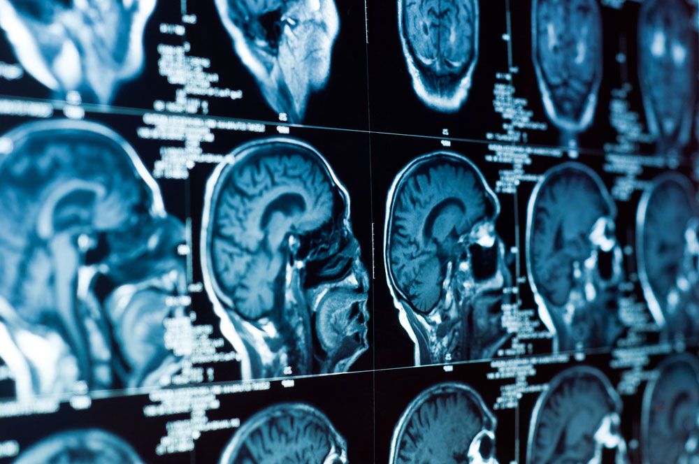 Multiple images of a CT scan of a human head.