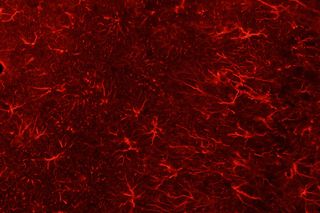 Glia contribute to learning and memory