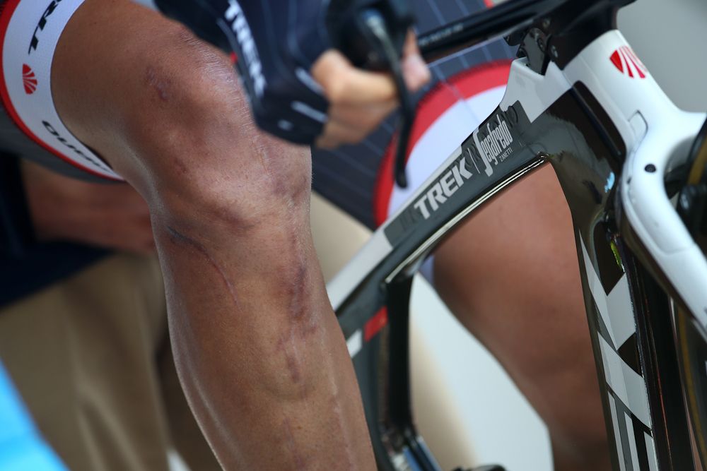 Scars on Stetina's leg are there to remind him of what he's overcome.