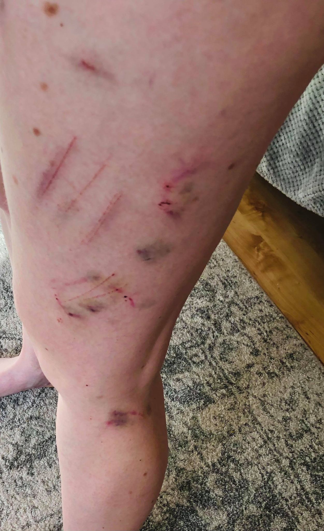 dog attack