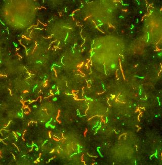 This confetti-like image is <em>Borrelia burgdorferi</em>, the bacteria that causes Lyme Disease.