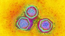 Microscope image shows three circular blobs that are positioned in a triangle orientation. They are multicolored with lots of dots in the center. The background is bright yellow