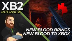 XB2 interview logo