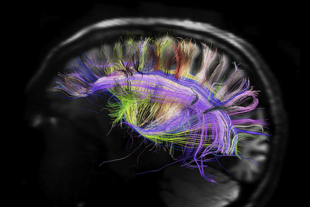 magnetic resonance imaging, xray