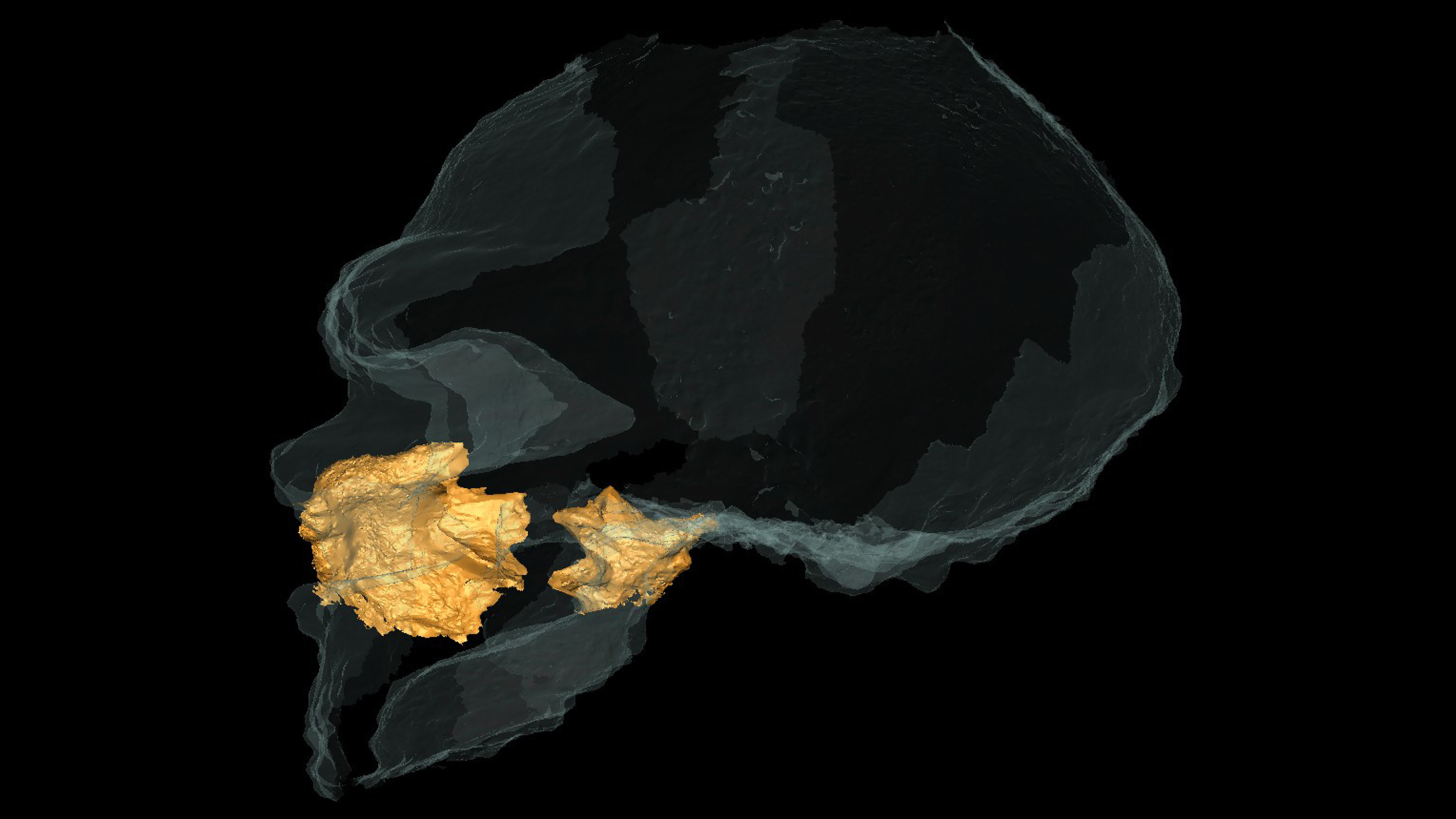 side view of a skull outline with nasal bones filled in in yellow