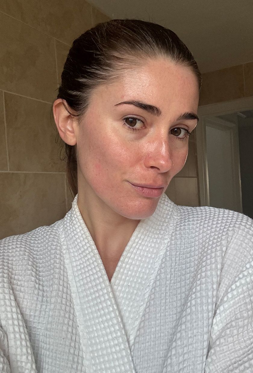 Eleanor's skin after using the Shark FacialPro Glow + Depuffi device
