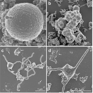 Scanning electron microscopy images show (A) a single archaea (B) multiple cells growing together in the lab (C&D) archaea with tentacle-like protrusions that occur toward the end of their growth.