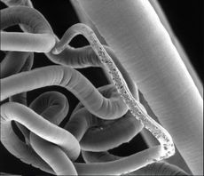 An image of an adult whipworm, taken with a scanning electron microscope. New research finds that these parasites have their own gut bacteria.