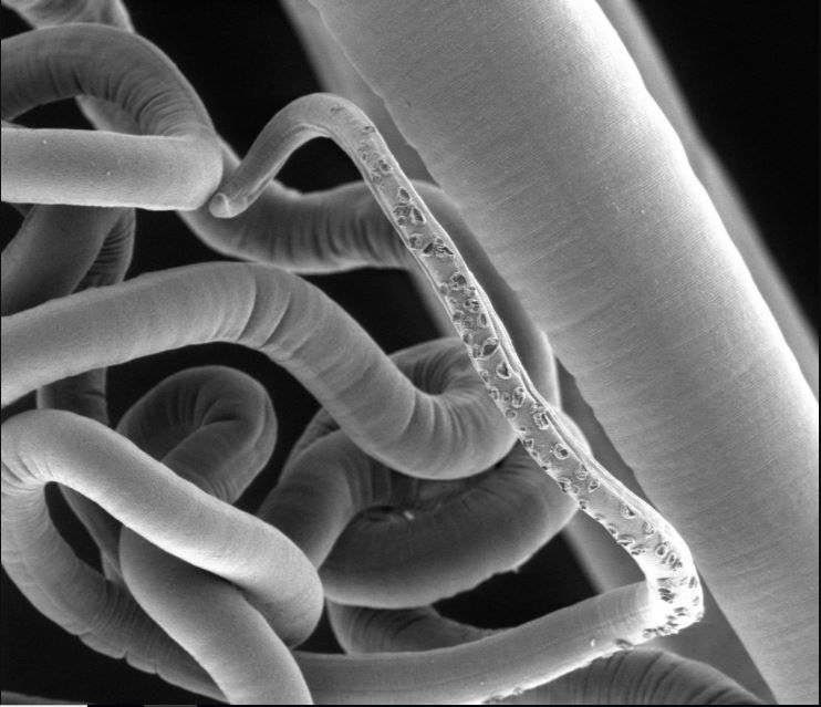 An image of an adult whipworm, taken with a scanning electron microscope. New research finds that these parasites have their own gut bacteria.