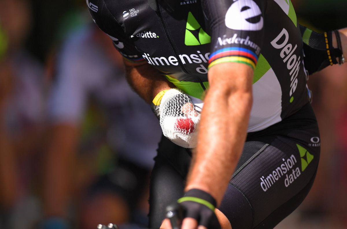 Mark Cavendish with a badly cut left hand