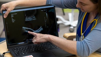 A woman points to an ultrasound image on a laptop.